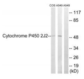 Western blot - Cytochrome P450 2J2 Antibody from Signalway Antibody (34239) - Antibodies.com