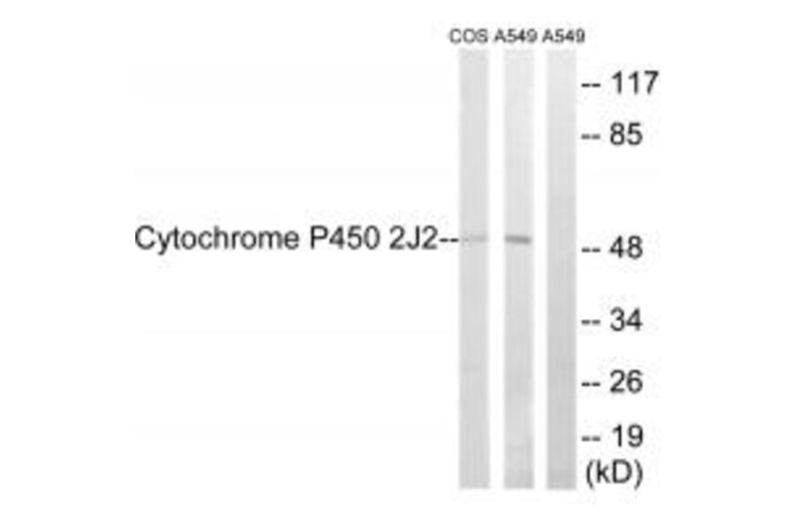 Western blot - Cytochrome P450 2J2 Antibody from Signalway Antibody (34239) - Antibodies.com