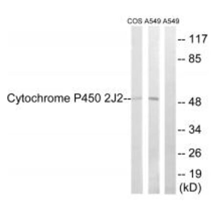 Western blot - Cytochrome P450 2J2 Antibody from Signalway Antibody (34239) - Antibodies.com