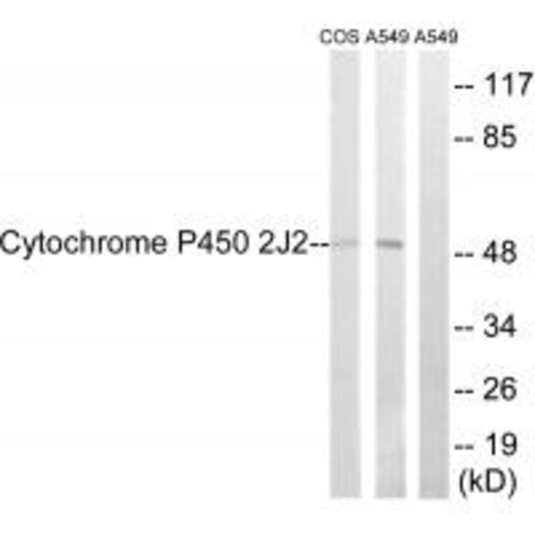 Western blot - Cytochrome P450 2J2 Antibody from Signalway Antibody (34239) - Antibodies.com