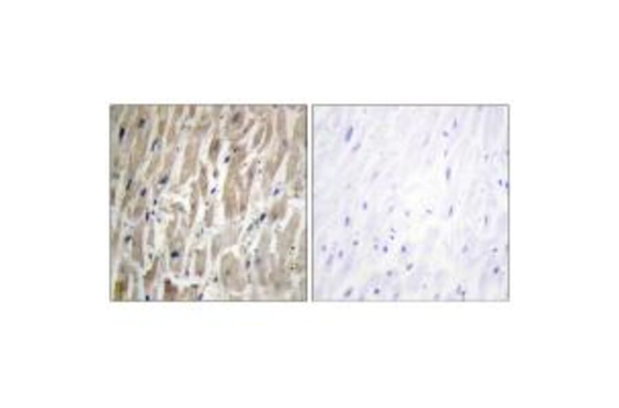 Immunohistochemistry - Cytochrome P450 2J2 Antibody from Signalway Antibody (34239) - Antibodies.com