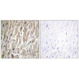 Immunohistochemistry - Cytochrome P450 2J2 Antibody from Signalway Antibody (34239) - Antibodies.com