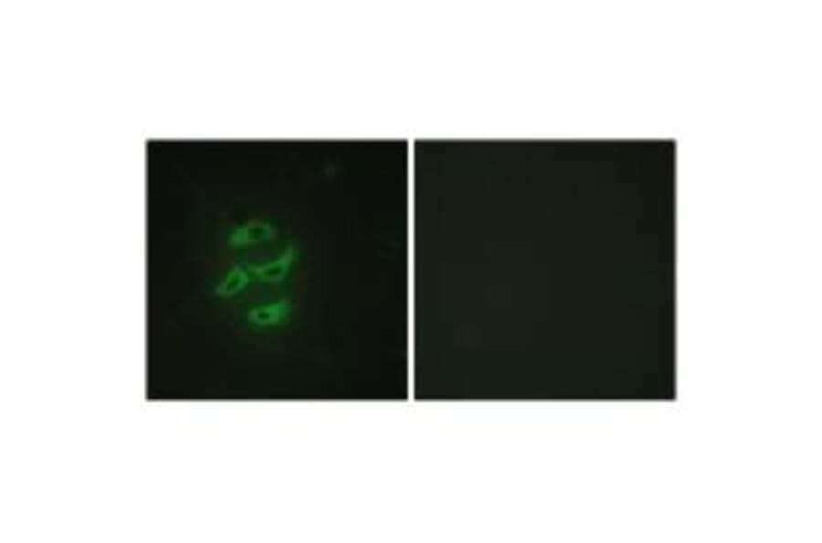 Immunofluorescence - Cytochrome P450 2J2 Antibody from Signalway Antibody (34239) - Antibodies.com