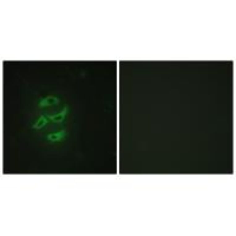 Immunofluorescence - Cytochrome P450 2J2 Antibody from Signalway Antibody (34239) - Antibodies.com