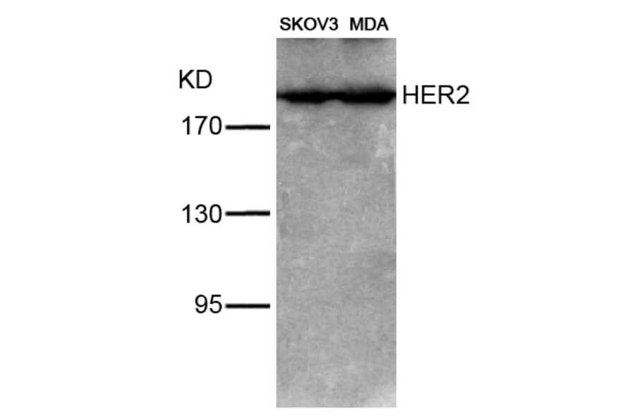 Western blot - HER2 (Ab-1221/1222) Antibody from Signalway Antibody (21071) - Antibodies.com