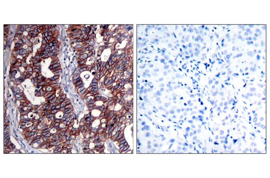 Immunohistochemistry - HER2 (Ab-1221/1222) Antibody from Signalway Antibody (21071) - Antibodies.com