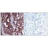 Immunohistochemistry - HER2 (Ab-1221/1222) Antibody from Signalway Antibody (21071) - Antibodies.com