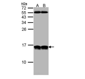 NHP2-like protein 1 antibody from Signalway Antibody (22023) - Antibodies.com