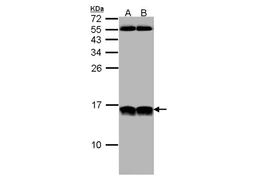NHP2-like protein 1 antibody from Signalway Antibody (22023) - Antibodies.com