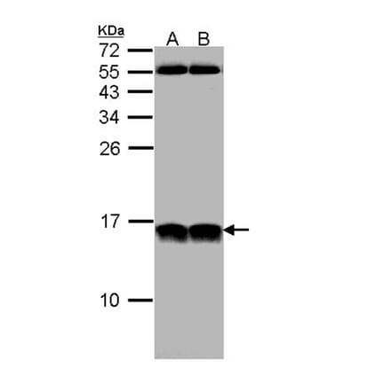 NHP2-like protein 1 antibody from Signalway Antibody (22023) - Antibodies.com