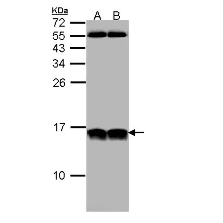NHP2-like protein 1 antibody from Signalway Antibody (22023) - Antibodies.com