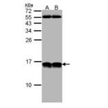 NHP2-like protein 1 antibody from Signalway Antibody (22023) - Antibodies.com