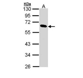 Pancreatic Lipase antibody from Signalway Antibody (22153) - Antibodies.com