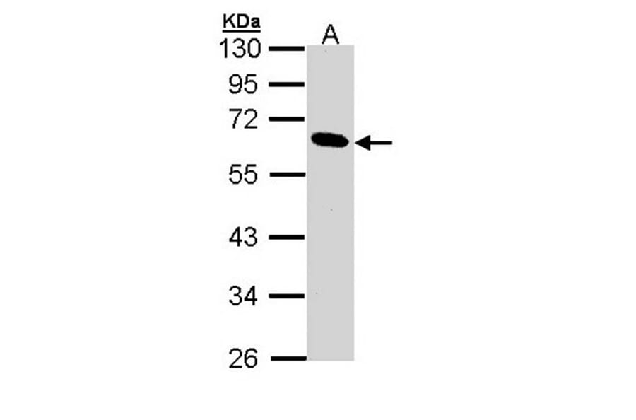 Pancreatic Lipase antibody from Signalway Antibody (22153) - Antibodies.com