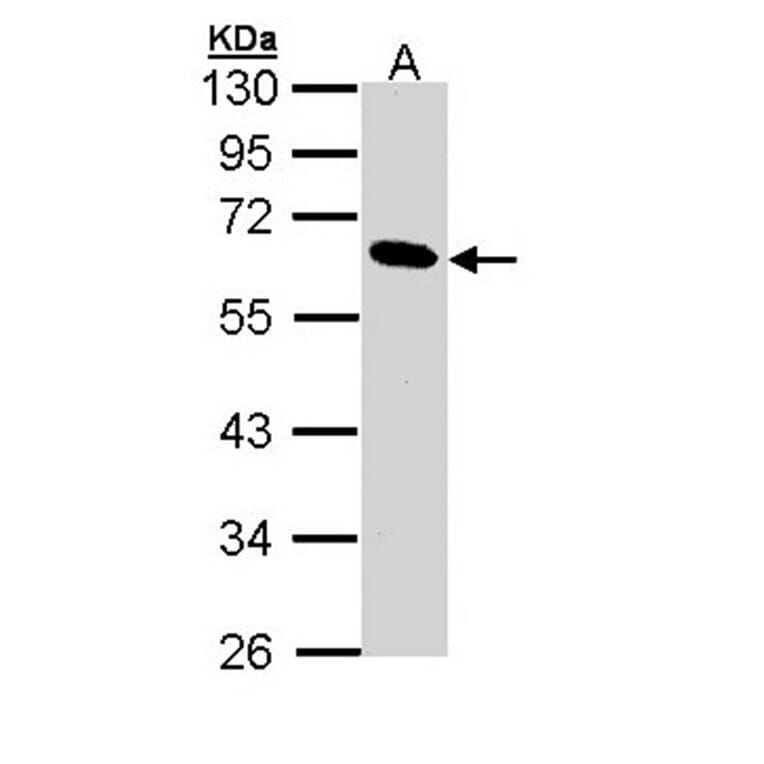 Pancreatic Lipase antibody from Signalway Antibody (22153) - Antibodies.com