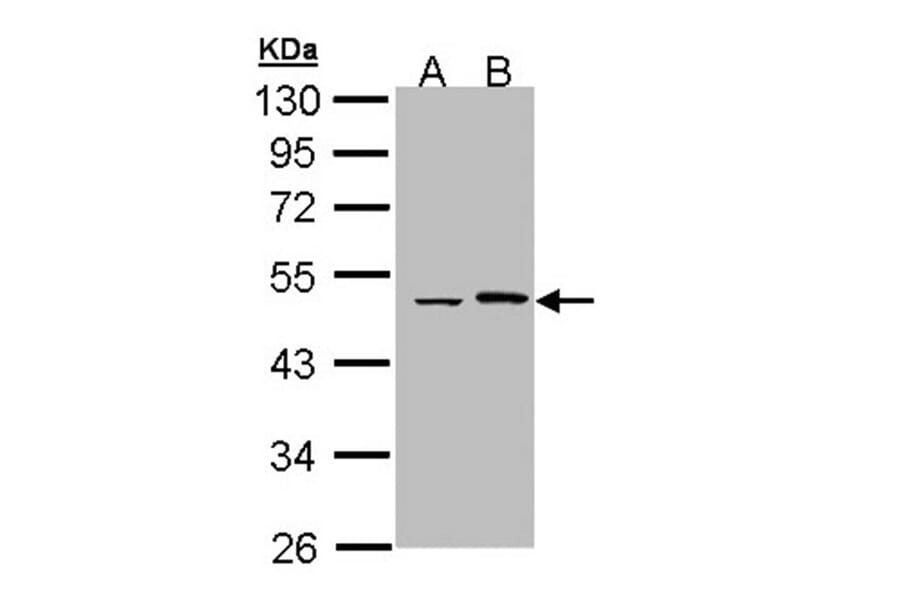 Epoxide hydrolase 1 antibody from Signalway Antibody (22633) - Antibodies.com