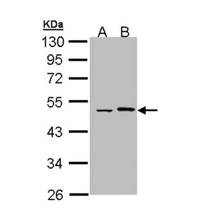 Epoxide hydrolase 1 antibody from Signalway Antibody (22633) - Antibodies.com