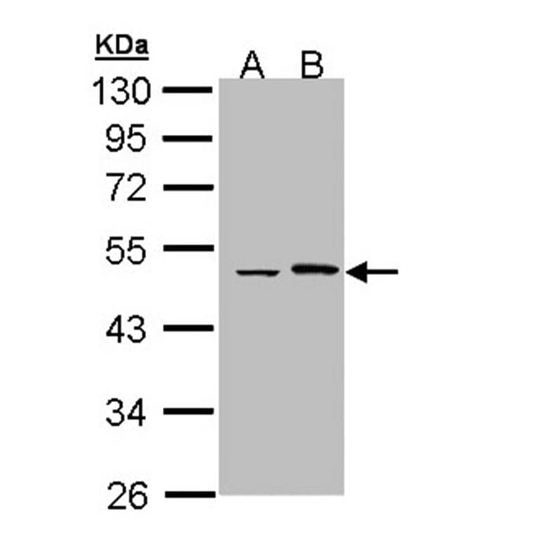 Epoxide hydrolase 1 antibody from Signalway Antibody (22633) - Antibodies.com