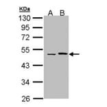 Epoxide hydrolase 1 antibody from Signalway Antibody (22633) - Antibodies.com