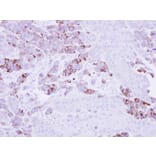 Immunohistochemistry - Epoxide hydrolase 1 antibody from Signalway Antibody (22633) - Antibodies.com