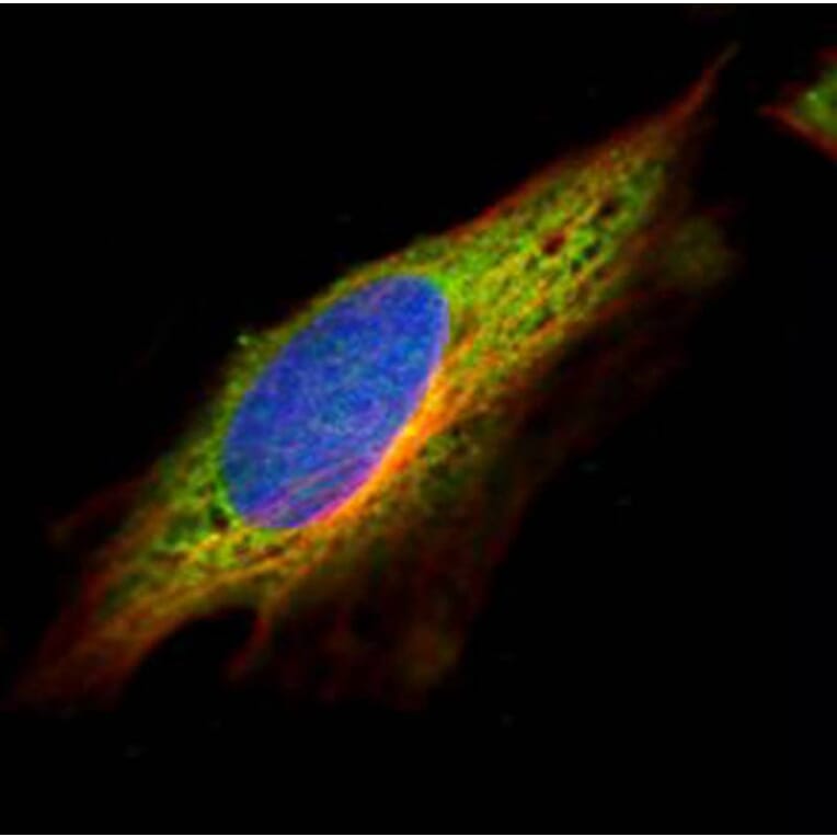 Epoxide hydrolase 1 antibody from Signalway Antibody (22633) - Antibodies.com