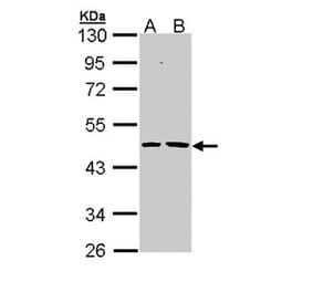 Epoxide hydrolase 1 antibody from Signalway Antibody (22634) - Antibodies.com