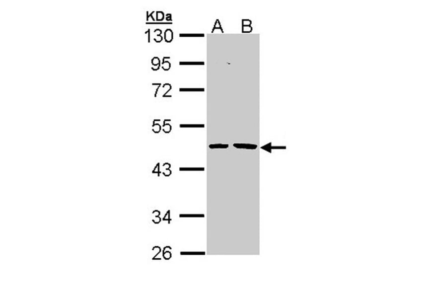 Epoxide hydrolase 1 antibody from Signalway Antibody (22634) - Antibodies.com