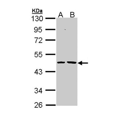Epoxide hydrolase 1 antibody from Signalway Antibody (22634) - Antibodies.com