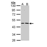 Epoxide hydrolase 1 antibody from Signalway Antibody (22634) - Antibodies.com