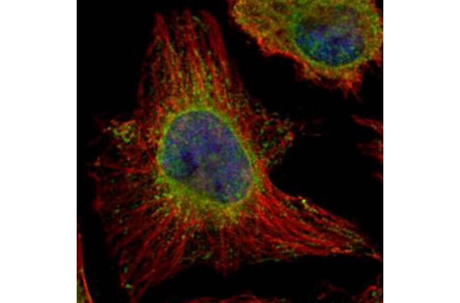 Epoxide hydrolase 1 antibody from Signalway Antibody (22634) - Antibodies.com