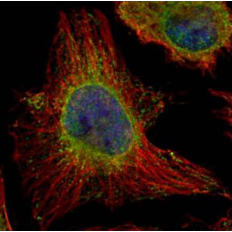 Epoxide hydrolase 1 antibody from Signalway Antibody (22634) - Antibodies.com