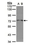 RPA 70 kDa subunit antibody from Signalway Antibody (22833) - Antibodies.com