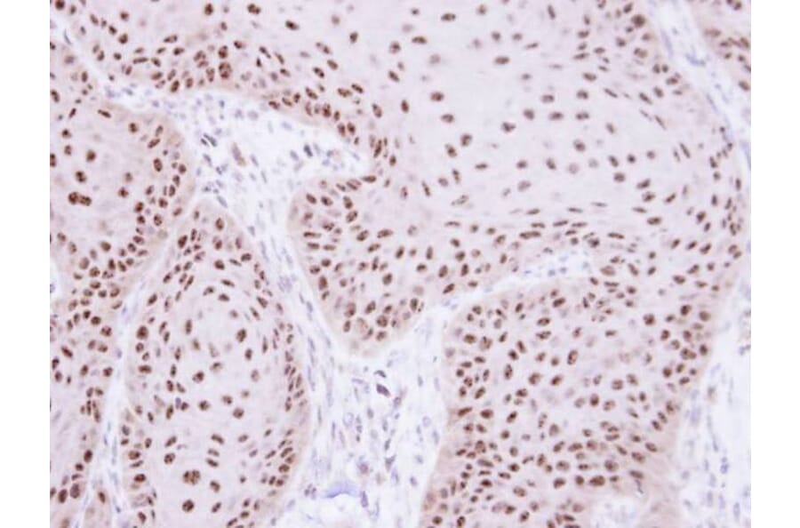 Immunohistochemistry - RPA 70 kDa subunit antibody from Signalway Antibody (22833) - Antibodies.com