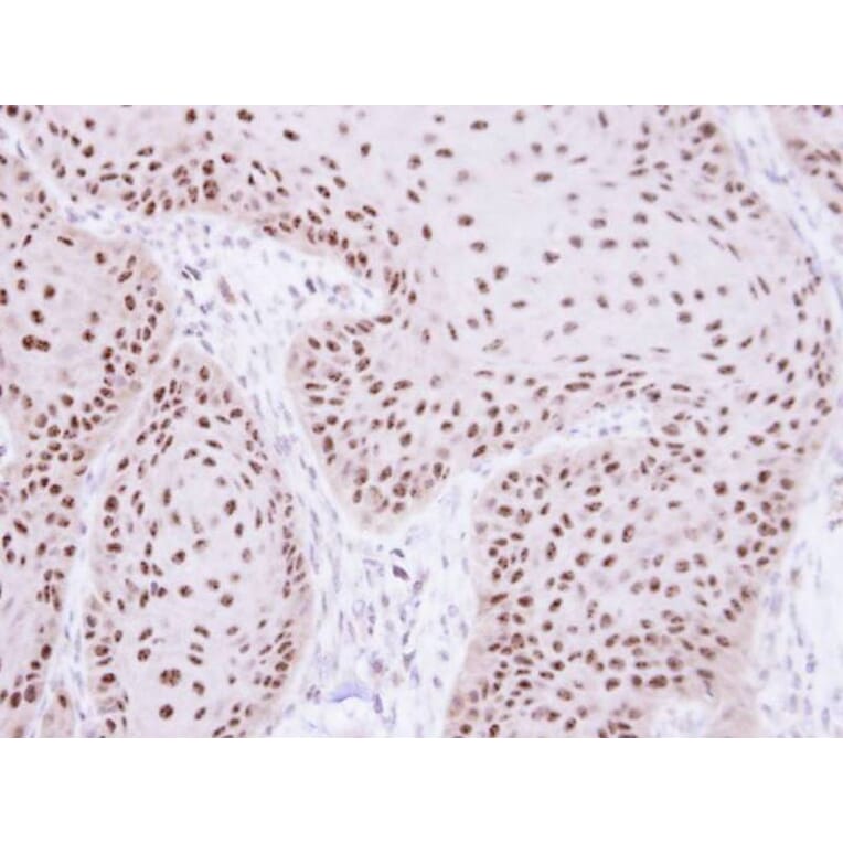 Immunohistochemistry - RPA 70 kDa subunit antibody from Signalway Antibody (22833) - Antibodies.com