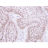 Immunohistochemistry - RPA 70 kDa subunit antibody from Signalway Antibody (22833) - Antibodies.com