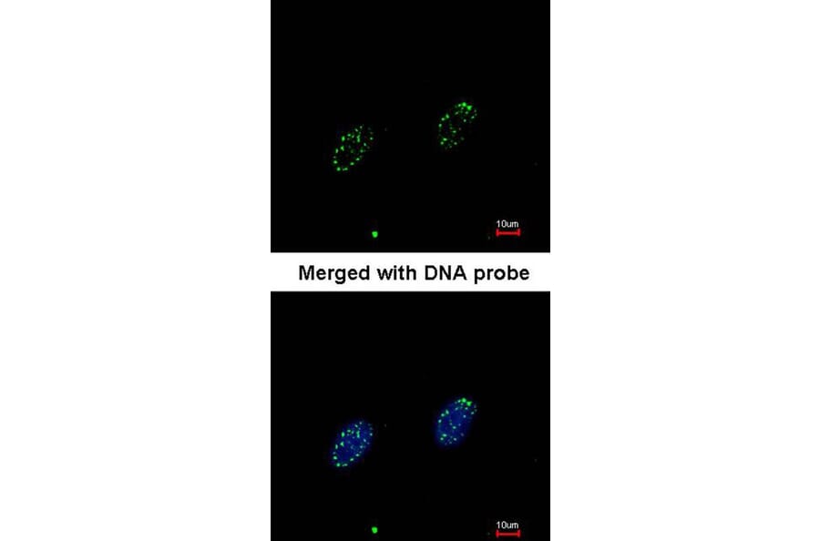 Immunofluorescence - RPA 70 kDa subunit antibody from Signalway Antibody (22833) - Antibodies.com