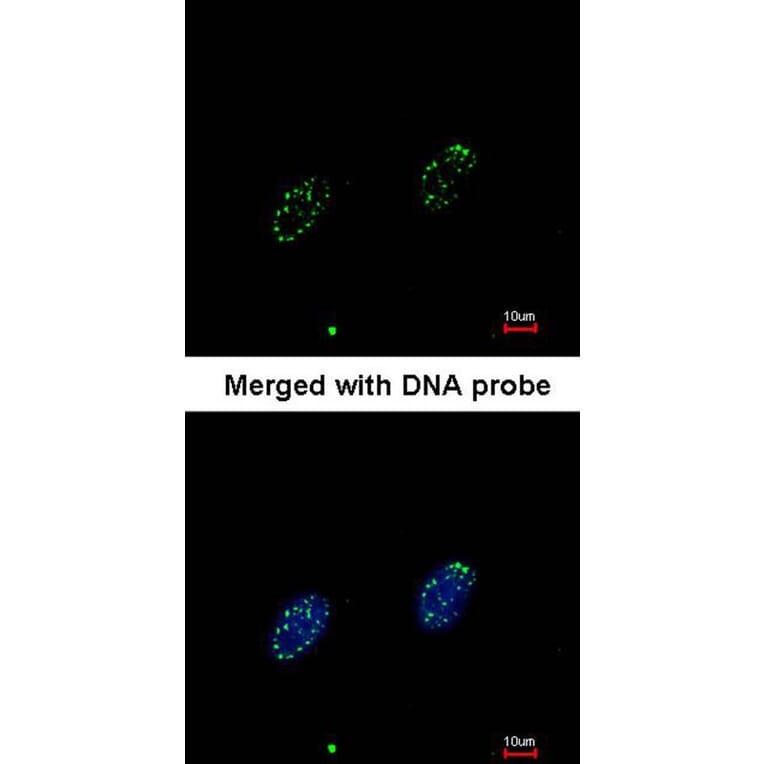 Immunofluorescence - RPA 70 kDa subunit antibody from Signalway Antibody (22833) - Antibodies.com