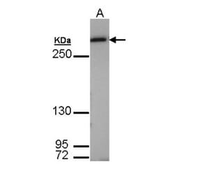 Fatty Acid Synthase antibody from Signalway Antibody (22867) - Antibodies.com