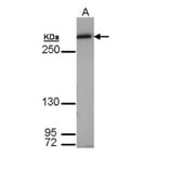 Fatty Acid Synthase antibody from Signalway Antibody (22867) - Antibodies.com