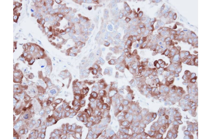 Immunohistochemistry - Fatty Acid Synthase antibody from Signalway Antibody (22867) - Antibodies.com