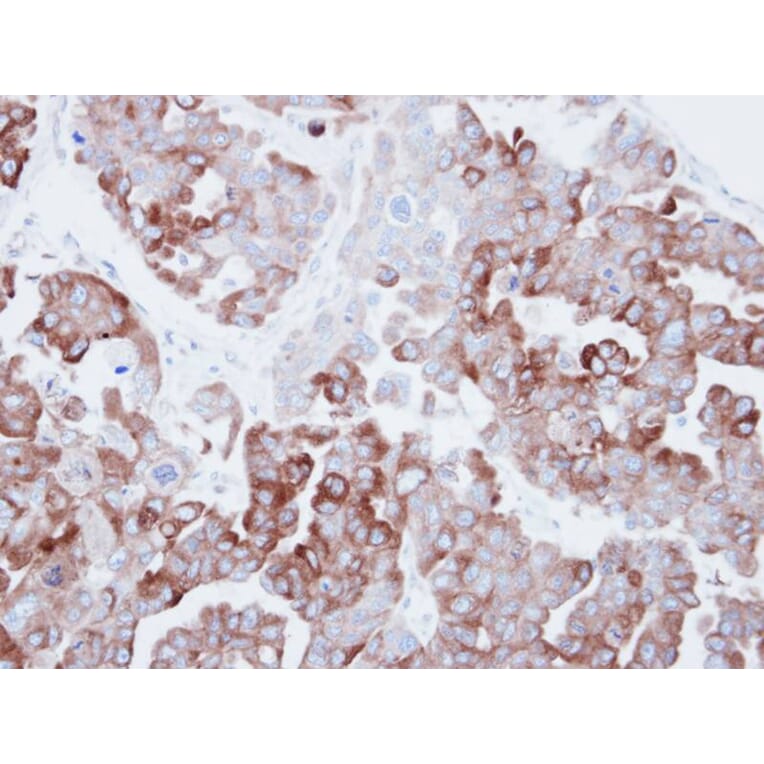 Immunohistochemistry - Fatty Acid Synthase antibody from Signalway Antibody (22867) - Antibodies.com