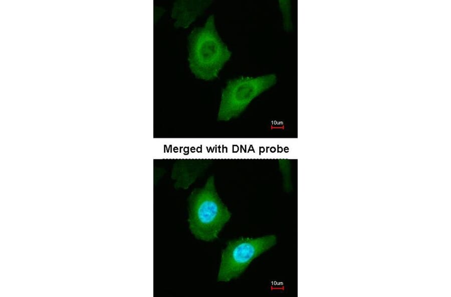 Immunofluorescence - Fatty Acid Synthase antibody from Signalway Antibody (22867) - Antibodies.com