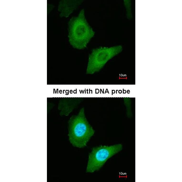 Immunofluorescence - Fatty Acid Synthase antibody from Signalway Antibody (22867) - Antibodies.com