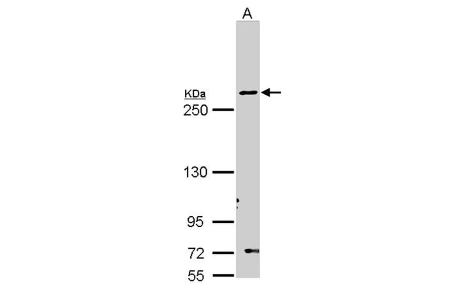 Fatty Acid Synthase antibody from Signalway Antibody (22868) - Antibodies.com