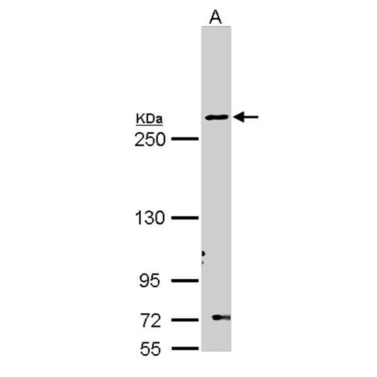 Fatty Acid Synthase antibody from Signalway Antibody (22868) - Antibodies.com