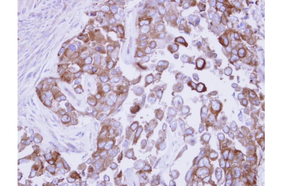 Immunohistochemistry - Fatty Acid Synthase antibody from Signalway Antibody (22868) - Antibodies.com