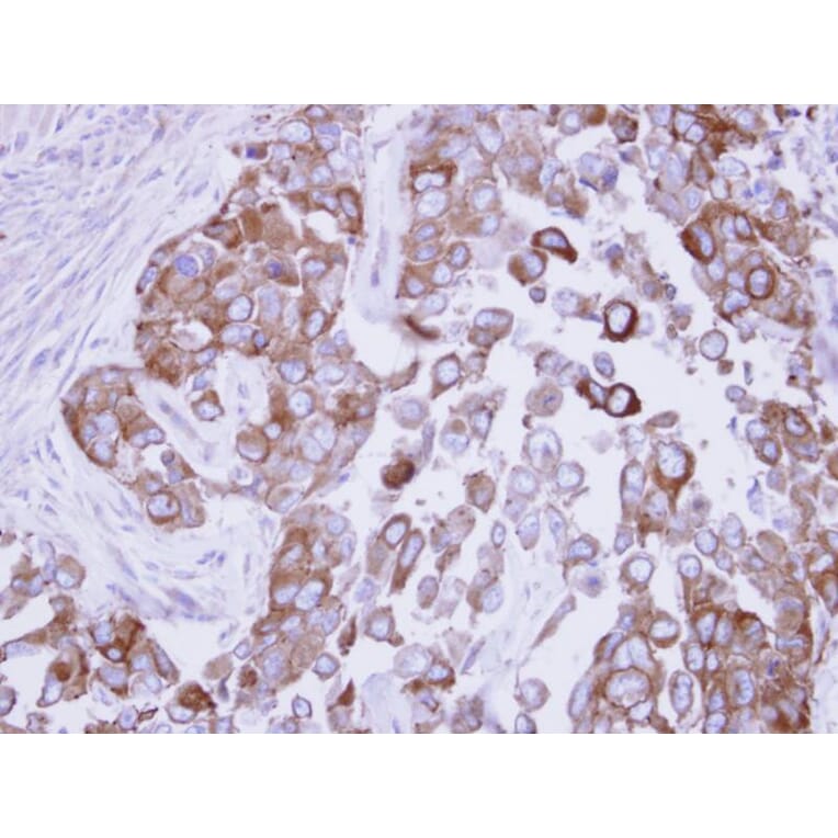 Immunohistochemistry - Fatty Acid Synthase antibody from Signalway Antibody (22868) - Antibodies.com