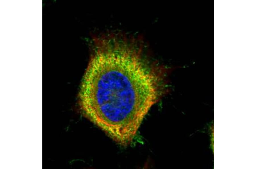 Fatty Acid Synthase antibody from Signalway Antibody (22868) - Antibodies.com
