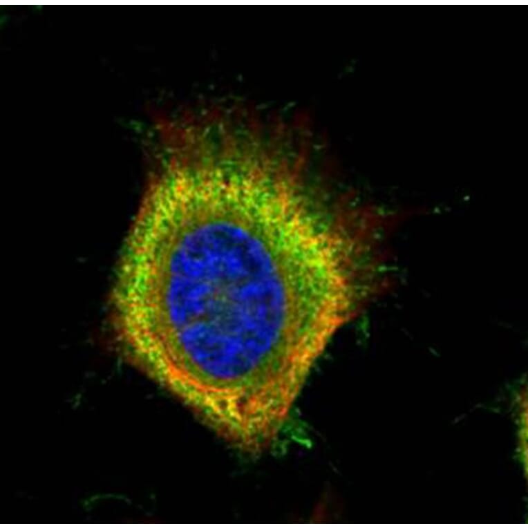 Fatty Acid Synthase antibody from Signalway Antibody (22868) - Antibodies.com