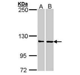 Adenosine Deaminase antibody from Signalway Antibody (22950) - Antibodies.com